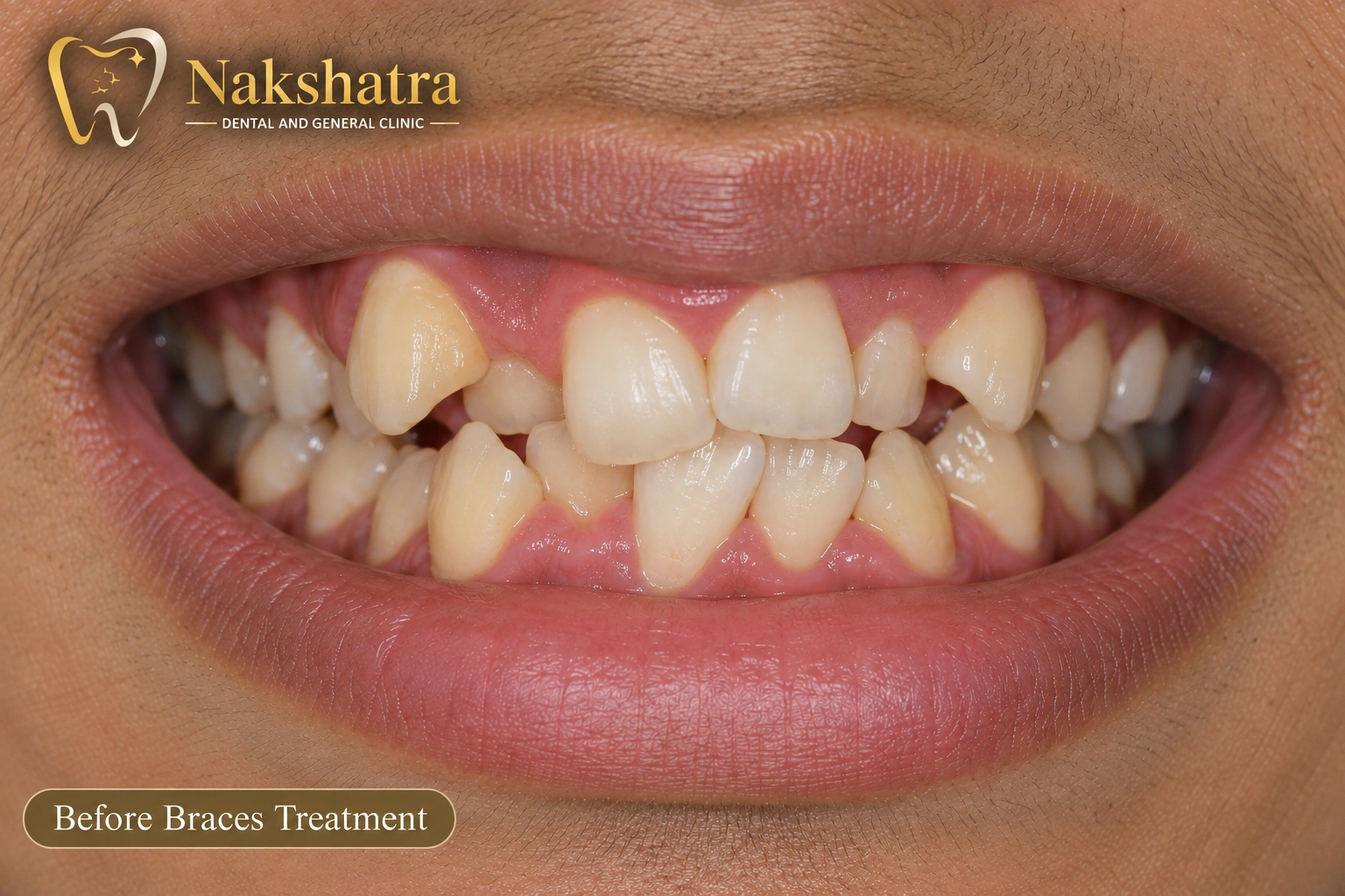 Before dental smile transformation, case 3